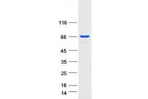 Validation with Western Blot (UTP6 Protein (Myc-DYKDDDDK Tag))