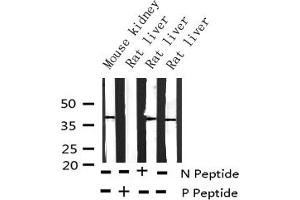 Western Blotting (WB) image for anti-V-Crk Sarcoma Virus CT10 Oncogene Homolog (Avian) (CRK) (pTyr221) antibody (ABIN6256674)