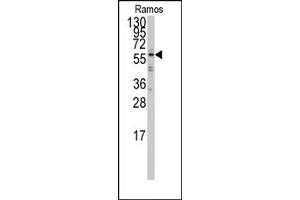 Image no. 1 for anti-Interferon Regulatory Factor 5 (IRF5) (N-Term) antibody (ABIN357996) (IRF5 antibody  (N-Term))
