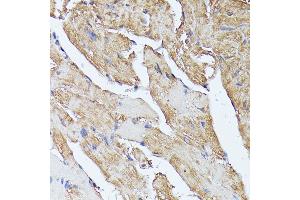 Immunohistochemistry (IHC) image for anti-Histidine Ammonia-Lyase (HAL) (AA 1-200) antibody (ABIN6141593)