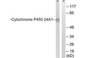 Western blot analysis of extracts from JurKat cells, using Cytochrome P450 24A1 Antibody. (CYP24A1 antibody  (AA 411-460))