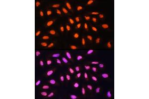 Immunofluorescence analysis of U-2 OS cells using KA Rabbit pAb (ABIN1679964, ABIN5664011, ABIN5664013 and ABIN6219456) at dilution of 1:100 (40x lens). (KAT2A antibody  (AA 1-100))
