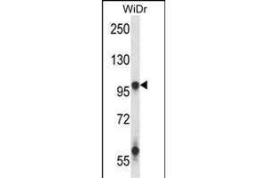 GRIA3 Antibody (N-term) (ABIN657962 and ABIN2846908) western blot analysis in WiDr cell line lysates (35 μg/lane). (Glutamate Receptor 3 antibody  (N-Term))