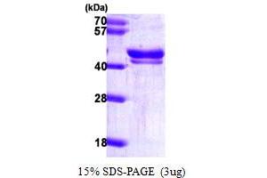SDS-PAGE (SDS) image for DNA Fragmentation Factor, 45kDa, alpha Polypeptide (DFFA) (AA 1-331) protein (His tag) (ABIN667128)