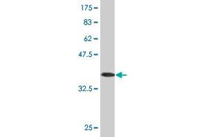 CYP4F3 antibody  (AA 100-198)