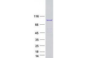 Validation with Western Blot (SPAG16 Protein (Transcript Variant 1) (Myc-DYKDDDDK Tag))