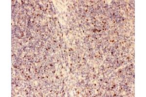 IHC-P: FOXP3 antibody testing of mouse spleen tissue (FOXP3 antibody  (AA 101-431))