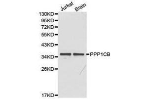 Western Blotting (WB) image for anti-Protein Phosphatase 1, Catalytic Subunit, beta Isoform (PPP1CB) antibody (ABIN1874218) (PPP1CB antibody)