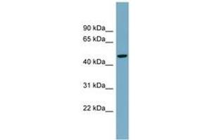 Image no. 1 for anti-Autophagy related 4A Cysteine Peptidase (ATG4A) (AA 251-300) antibody (ABIN6744729) (ATG4A antibody  (AA 251-300))