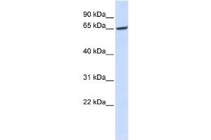 WB Suggested Anti-GPR177 Antibody Titration:  0. (GPR177/WLS antibody  (Middle Region))