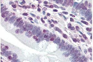 Human Small Intestine (formalin-fixed, paraffin-embedded) stained with DDX3X antibody ABIN396914 at 20 ug/ml followed by biotinylated goat anti-rabbit IgG secondary antibody ABIN481713, alkaline phosphatase-streptavidin and chromogen. (DDX3X antibody  (N-Term))