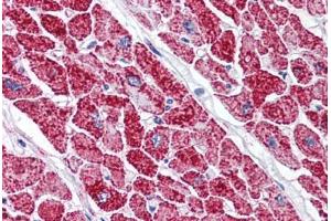 Human Heart (formalin-fixed, paraffin-embedded) stained with VDAC2 antibody ABIN337065 at 2. (VDAC2 antibody  (AA 298-309))