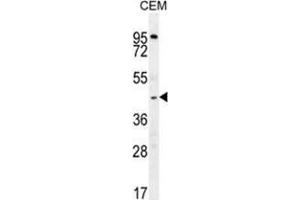 ZMYND10 Antibody (Center) western blot analysis in CEM cell line lysates (35 µg/lane). (ZMYND10 antibody  (Middle Region))
