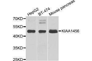 Western blot analysis of extracts of various cell lines, using KIAA1456 antibody (ABIN5974326) at 1/1000 dilution. (KIAA1456 antibody)