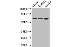 Adenylate Kinase 5 antibody  (AA 61-215)