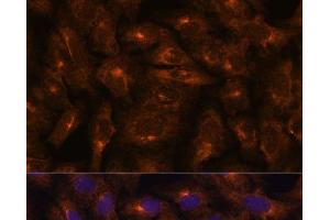 Immunofluorescence analysis of U-2 OS cells using IFITM3 Polyclonal Antibody at dilution of 1:100. (IFITM3 antibody)