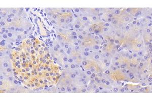 Detection of TF in Mouse Pancreas Tissue using Polyclonal Antibody to Tissue Factor (TF) (Tissue factor antibody  (AA 30-251))
