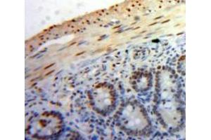 Used in DAB staining on fromalin fixed paraffin-embedded Bowels tissue (PPID antibody  (AA 9-189))