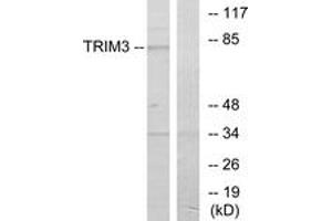 Western blot analysis of extracts from COLO cells, using TRIM3 Antibody. (TRIM3 antibody  (AA 1-50))