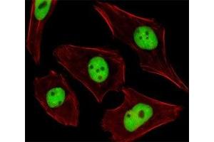 Fluorescent image of U251 cells stained with SUMO2/3 antibody. (SUMO2/3 antibody  (AA 49-81))