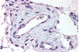 Human Testis, Vessels (formalin-fixed, paraffin-embedded) stained with ADAMTS1 antibody ABIN625844 at 1. (ADAMTS1 antibody  (Internal Region))