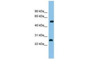 Image no. 1 for anti-Myocyte Enhancer Factor 2D (MEF2D) (C-Term) antibody (ABIN6744683) (MEF2D antibody  (C-Term))