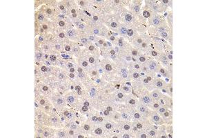 Immunohistochemistry (Paraffin-embedded Sections) (IHC (p)) image for anti-Heterogeneous Nuclear Ribonucleoprotein D (HNRNPD) (AA 1-306) antibody (ABIN6141905)