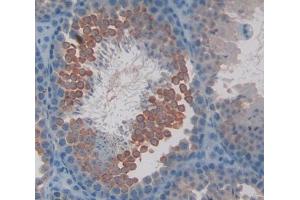 Used in DAB staining on fromalin fixed paraffin- embedded Kidney tissue (CAMLG antibody  (AA 1-187))