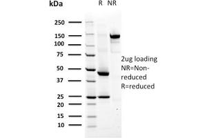 SDS-PAGE Analysis Purified MSH6 Mouse Monoclonal Antibody (MSH6/2927). (MSH6 antibody  (AA 374-540))