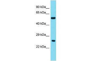 Host: Rabbit Target Name: ANKRD18A Sample Type: Fetal Liver lysates Antibody Dilution: 1. (ANKRD18A antibody  (C-Term))