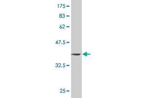Western Blot detection against Immunogen (37. (PAPPA antibody  (AA 85-194))