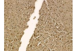 SARS Mouse Monoclonal Antibody at 1/100 staining human normal liver tissue by IHC-P.