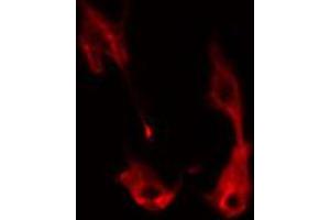 ABIN6274345 staining HeLa cells by IF/ICC. (ITPK1 antibody  (Internal Region))