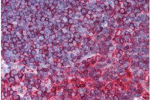 Human Thymus (formalin-fixed, paraffin-embedded) stained with TUBB antibody ABIN305890 at 1:100 followed by biotinylated goat anti-rabbit IgG secondary antibody ABIN481713, alkaline phosphatase-streptavidin and chromogen. (TUBB antibody  (N-Term) (Alexa Fluor 555))