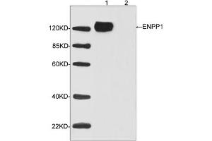 Western blot analysis of transfected HEK293 cell lysates using ENPP1 Antibody (ABIN398962, 1 µg/mL) Loading: Lane 1: Human ENPP1 expression in transfected HEK293 cell lysateLane 2: Non-transfected HEK293 cell lysateSecondary antibody: Donkey Anti-Goat IgG (H&L) [HRP] (ABIN398411, 1: 5,000) Predicted Size: 125 KD Observed Size: 125 KD