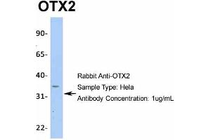 Western Blotting (WB) image for anti-Orthodenticle Homeobox 2 (OTX2) (N-Term) antibody (ABIN2779643)