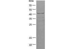 Western Blotting (WB) image for Dicer 1, Ribonuclease Type III (DICER1) (AA 1102-1314) protein (His-IF2DI Tag) (ABIN7282206) (DICER1 Protein (AA 1102-1314) (His-IF2DI Tag))