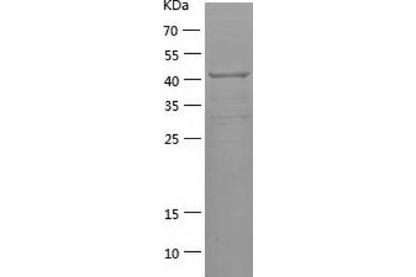 DICER1 Protein (AA 1102-1314) (His-IF2DI Tag)