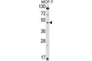 Western blot analysis of HSD11B2 in MCF-7 cell line lysates (35ug/lane). (HSD11B2 antibody  (Middle Region))