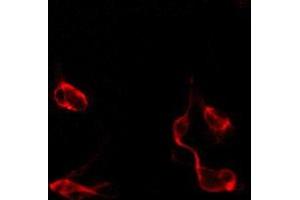 ABIN6274891 staining CoLo by IF/ICC. (DDX54 antibody  (Internal Region))