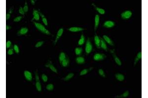 Immunofluorescence staining of Hela cells with ABIN7157190 at 1:100, counter-stained with DAPI. (Kallikrein 1 antibody  (AA 25-262))