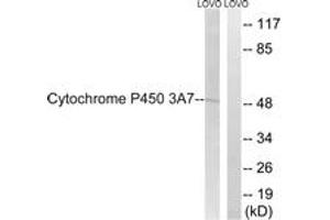 Western blot analysis of extracts from LOVO cells, using Cytochrome P450 3A7 Antibody. (CYP3A7 antibody  (AA 231-280))