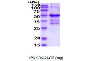 SDS-PAGE (SDS) image for Tumor Necrosis Factor Receptor Superfamily, Member 13B (TNFRSF13B) (AA 1-165) protein (hIgG-His-tag) (ABIN5854629) (TACI Protein (AA 1-165) (hIgG-His-tag))