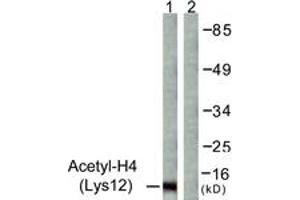 Western blot analysis of extracts from COS7 cells, treated with TSA 400nM 24h, using Histone H4 (Acetyl-Lys12) Antibody. (Histone H4 antibody  (acLys12))
