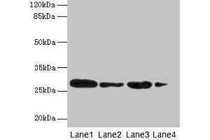 Western blot All lanes: MED7 antibody at 6 μg/mL Lane 1: Jurkat whole cell lysate Lane 2: Hela whole cell lysate Lane 3: Mouse thymus tissue Lane 4: NIH/3T3 whole cell lysate Secondary Goat polyclonal to rabbit IgG at 1/10000 dilution Predicted band size: 28 kDa Observed band size: 28 kDa