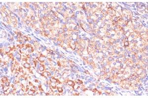 Immunohistochemistry of paraffin-embedded Rat ovary using VHL Polyclonal Antibody at dilution of 1:200 (40x lens). (VHL antibody)