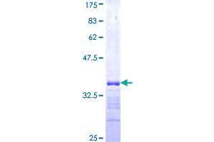 Ring Finger Protein 186 (RNF186) (AA 75-150) protein (GST tag)