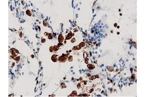 Immunohistochemical staining of paraffin-embedded Human colon tissue using anti-ARHGAP25 mouse monoclonal antibody. (ARHGAP25 antibody)