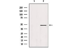 Western blot analysis of extracts from Hela, using DEK Antibody. (DEK antibody  (Internal Region))