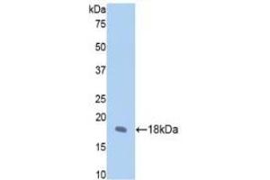 Detection of Recombinant FBN1, Rat using Polyclonal Antibody to Fibrillin 1 (FBN1) (Fibrillin 1 antibody  (AA 751-895))